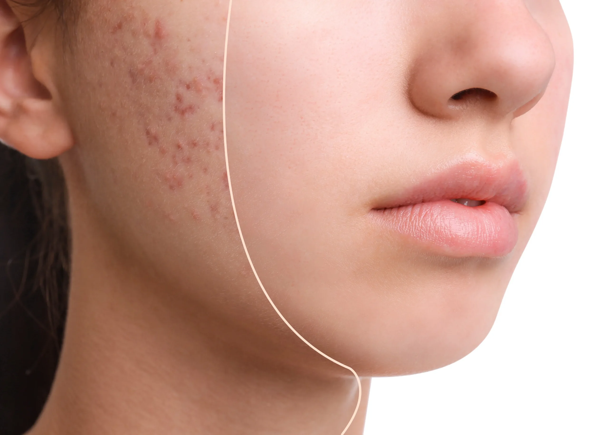 Procedimentos estéticos