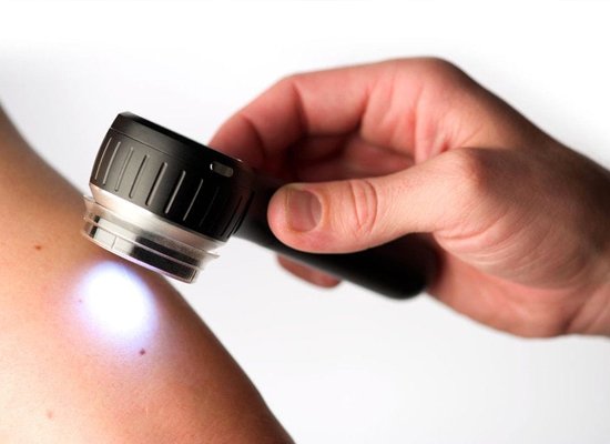 tratamentos_dermatoscopio